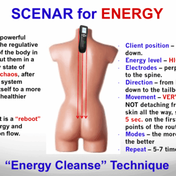 SCENAR "Energy Cleanse" technique diagram on a human torso model showing device placement.
