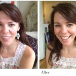 Before and after photos of a woman smiling, showing benefits of COSMODIC Ear-Brain Balancing.